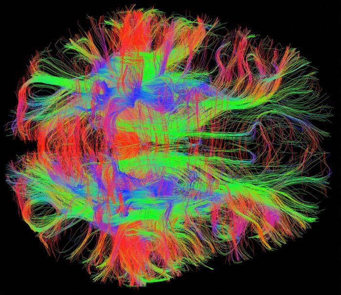 Профайлинг, нейротехнологии и детекция лжи:​ Мозг и выбор.